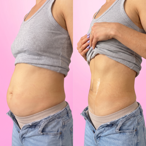 Kosvela · Cinta tensora invisible para el abdomen (pack de 10)